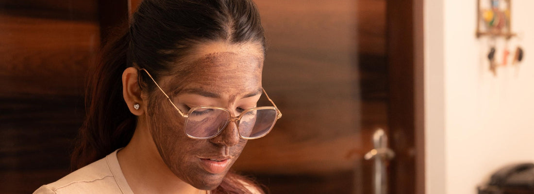 Why White Kaolin Clay is Great for Sensitive Skin