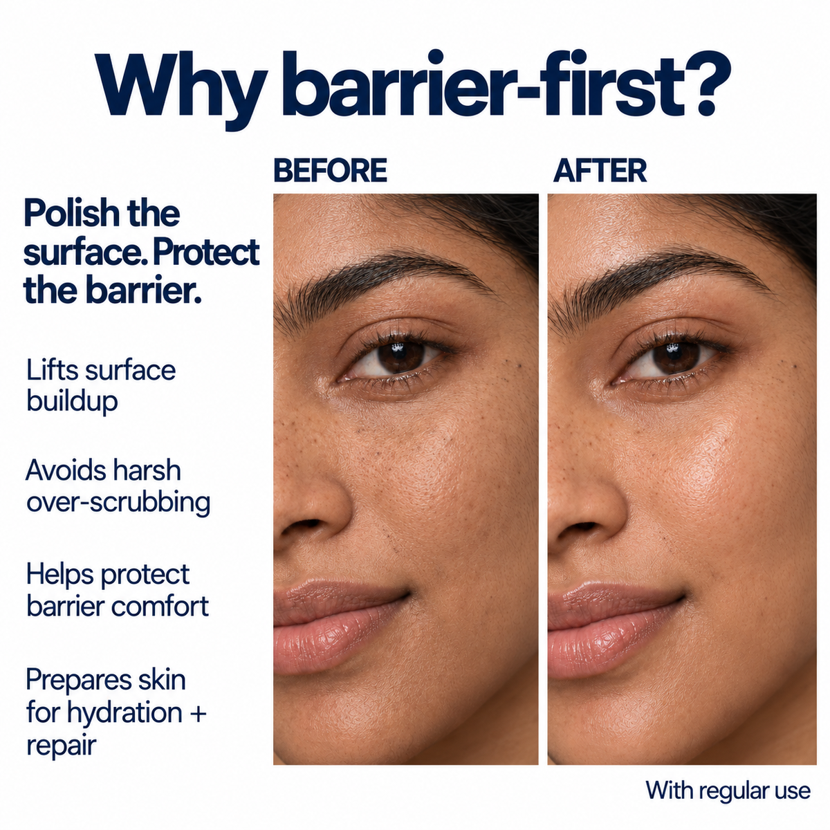 Barrier Polish — Precision Exfoliator