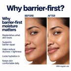 Barrier Synergy Complex - Moisturizing Emulsion