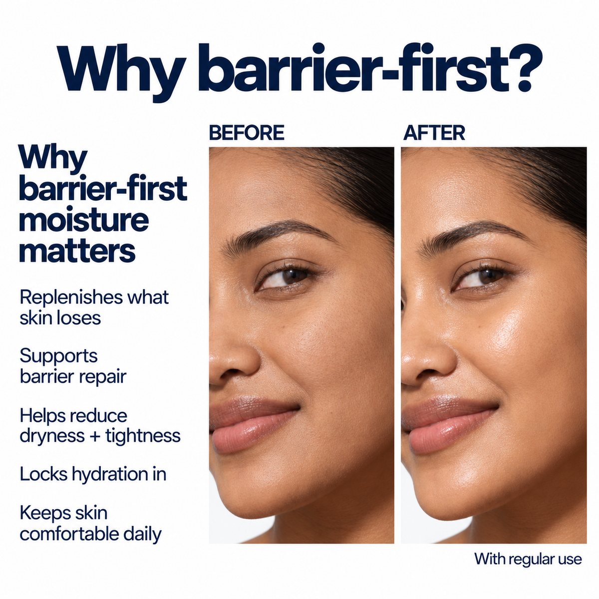 Barrier Synergy Complex - Moisturizing Emulsion